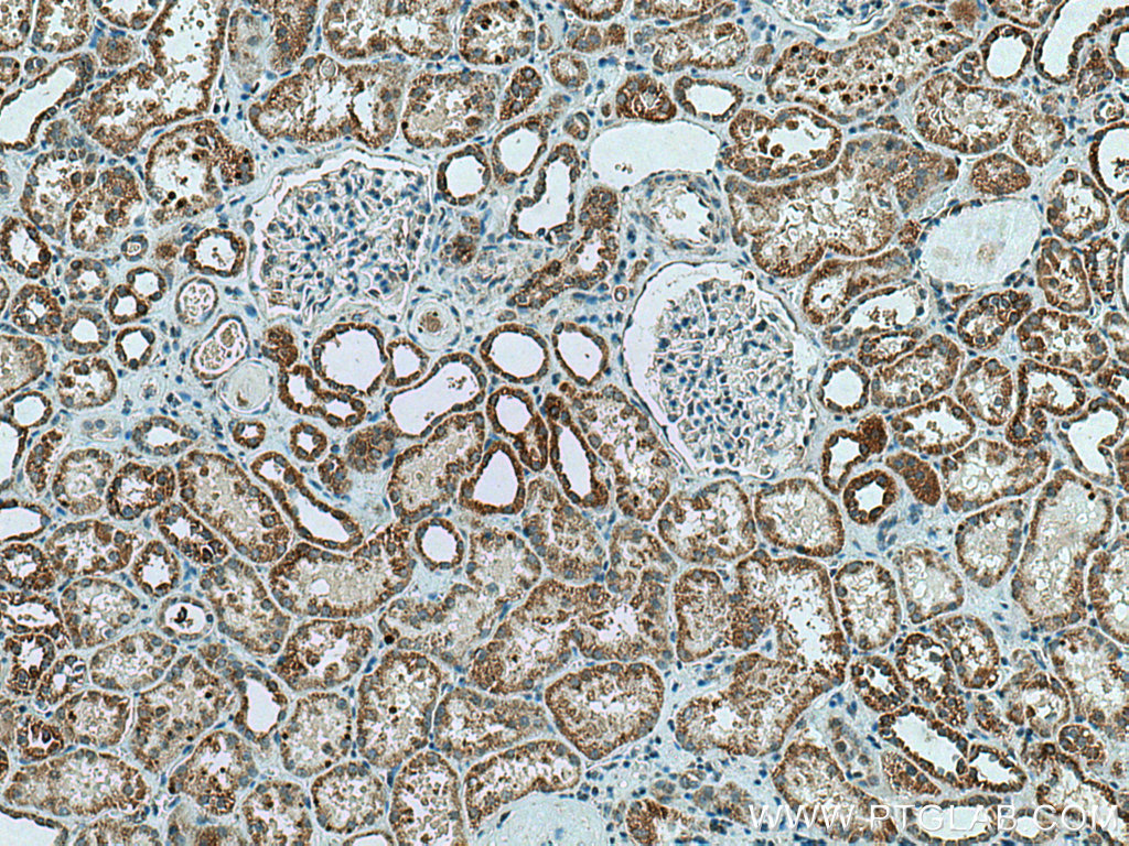 CA5B Polyclonal antibody