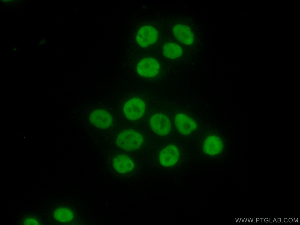 MCM6 Polyclonal antibody