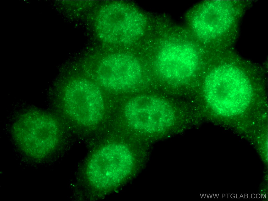 RAD17 Polyclonal antibody