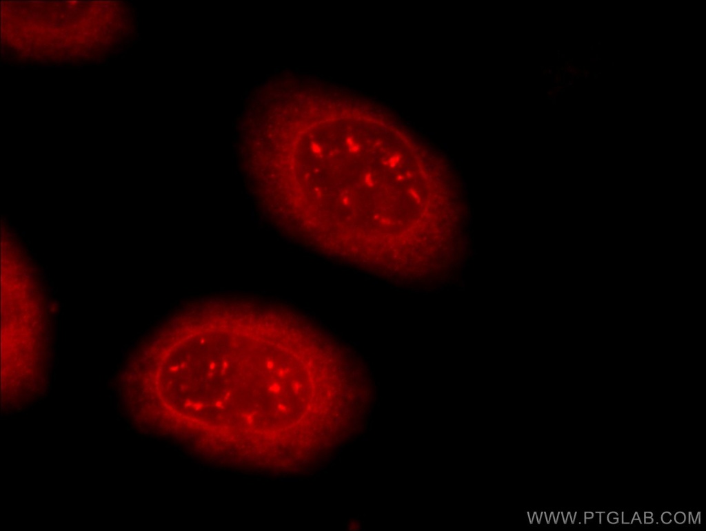 TDRD3 Polyclonal antibody