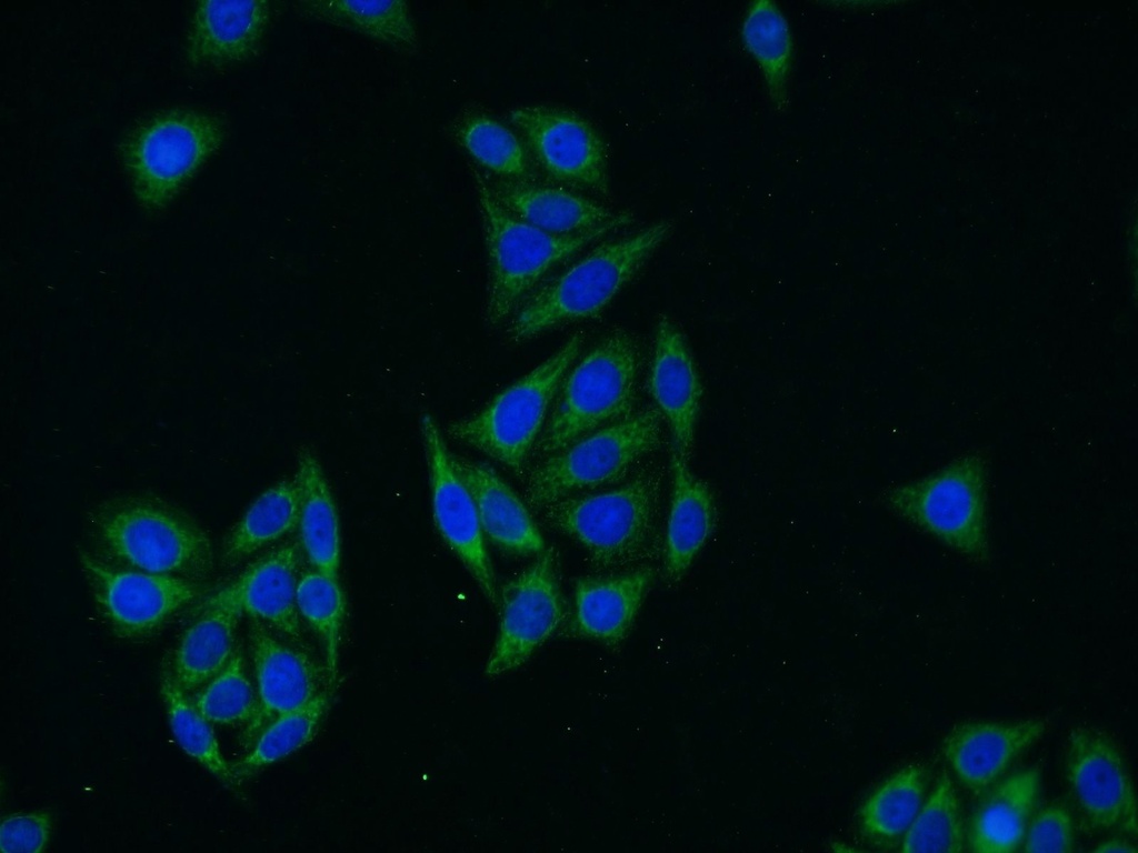 Glycerokinase Polyclonal antibody