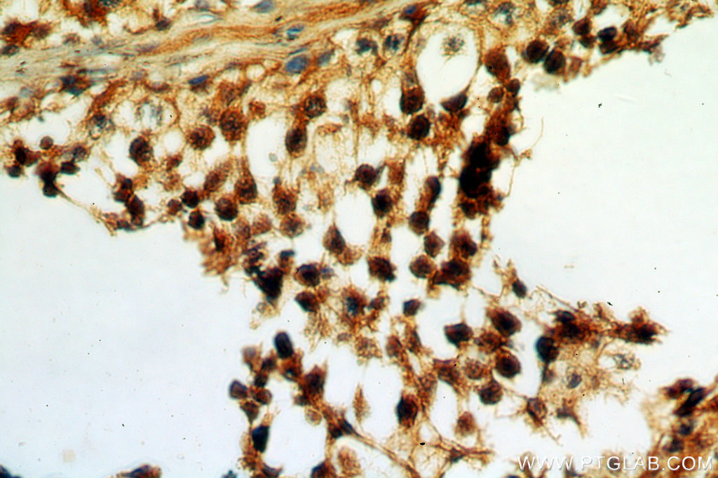 SPA17 Polyclonal antibody