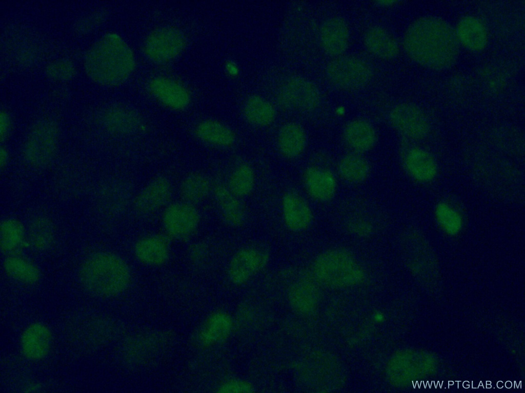 TDG Polyclonal antibody