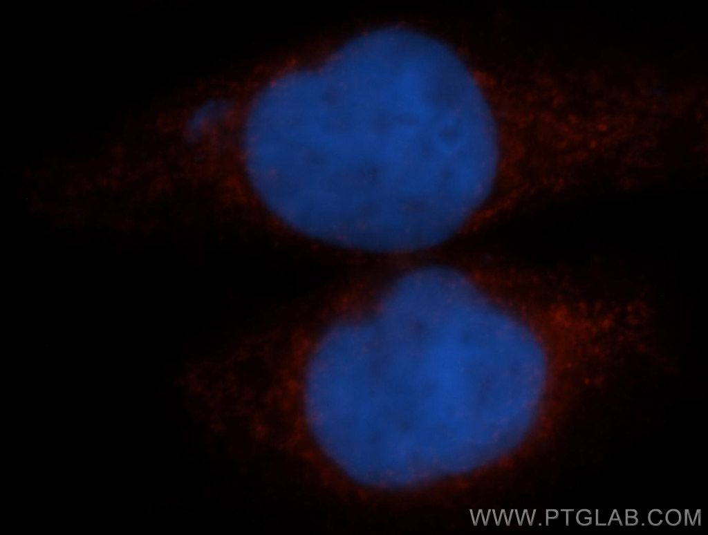 TFEB Polyclonal antibody