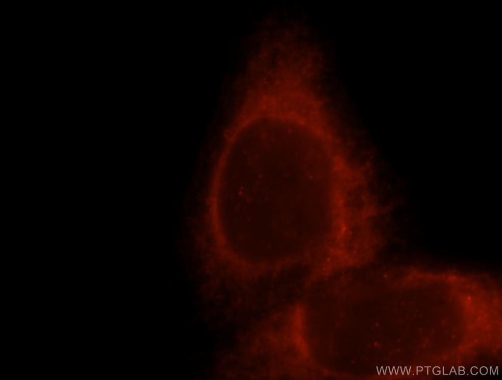 TRPV6 Polyclonal antibody
