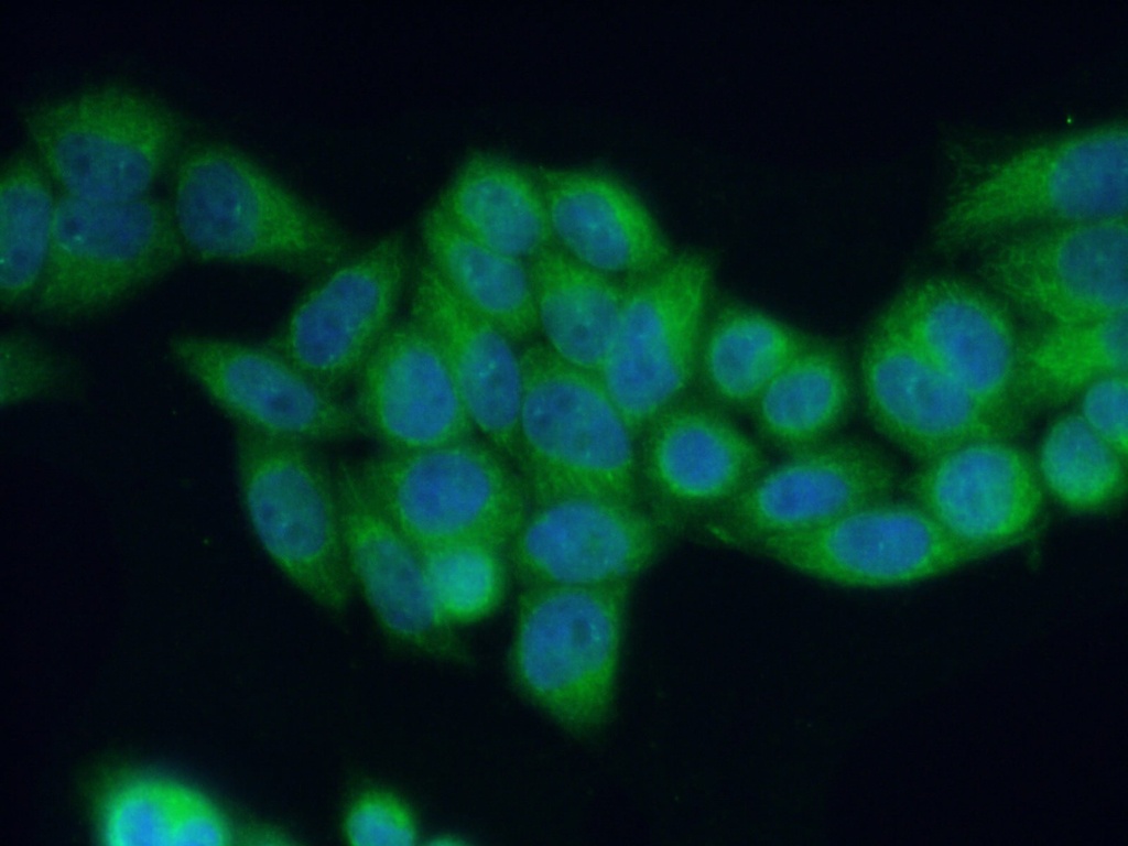 RAB27B Polyclonal antibody