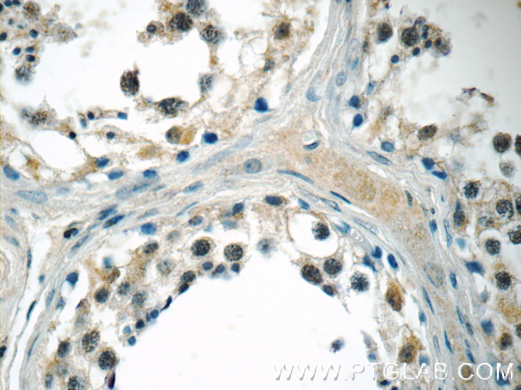 MED19 Polyclonal antibody