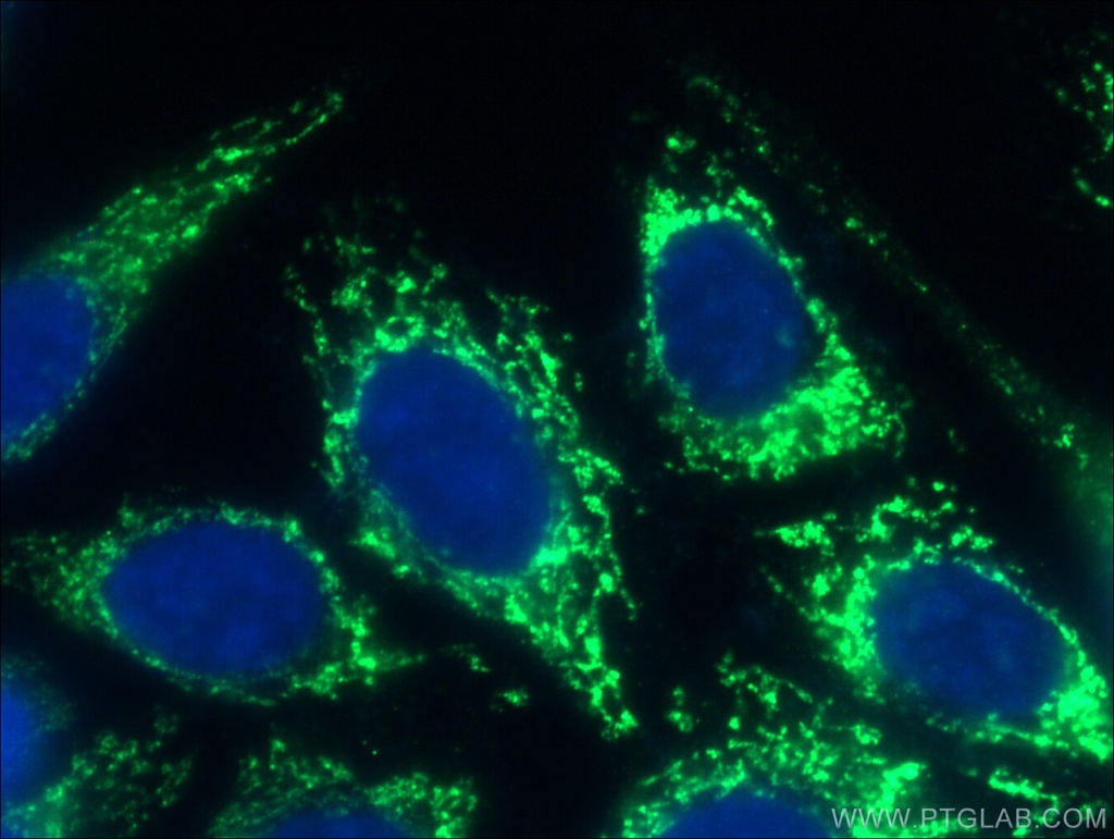 GSK3A Polyclonal antibody