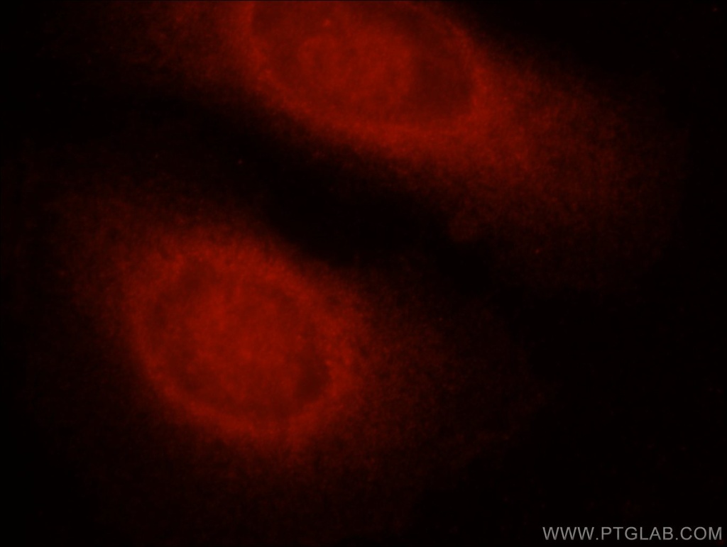 Caspase 8/p43/p18 Polyclonal antibody