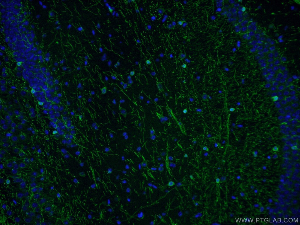 CNPase Polyclonal antibody