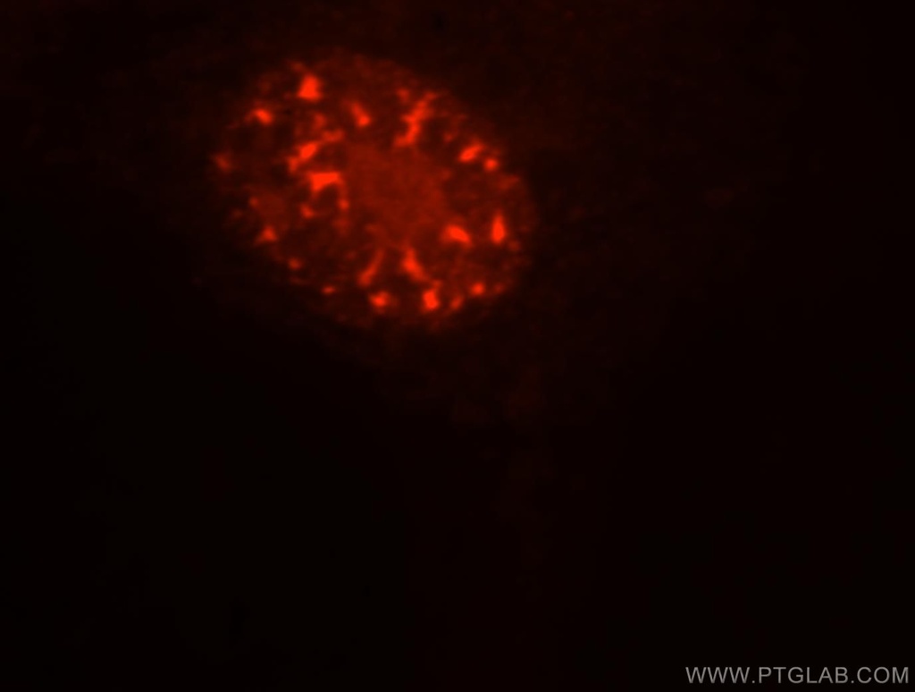 SFRS17A Polyclonal antibody