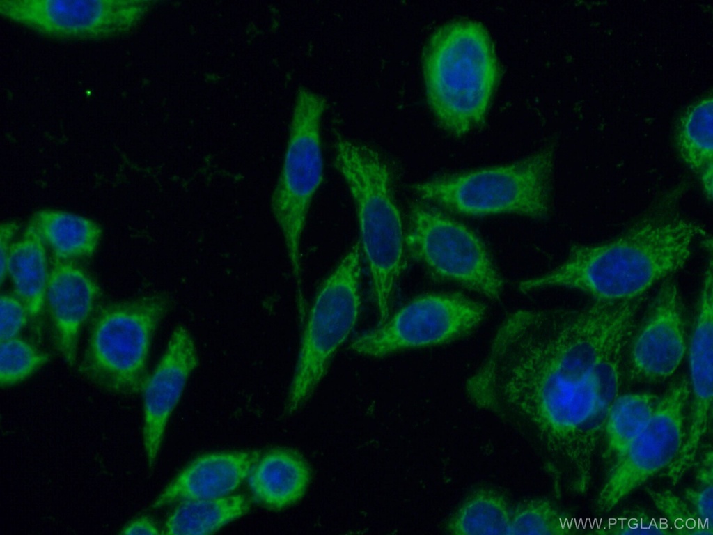 NNT Polyclonal antibody