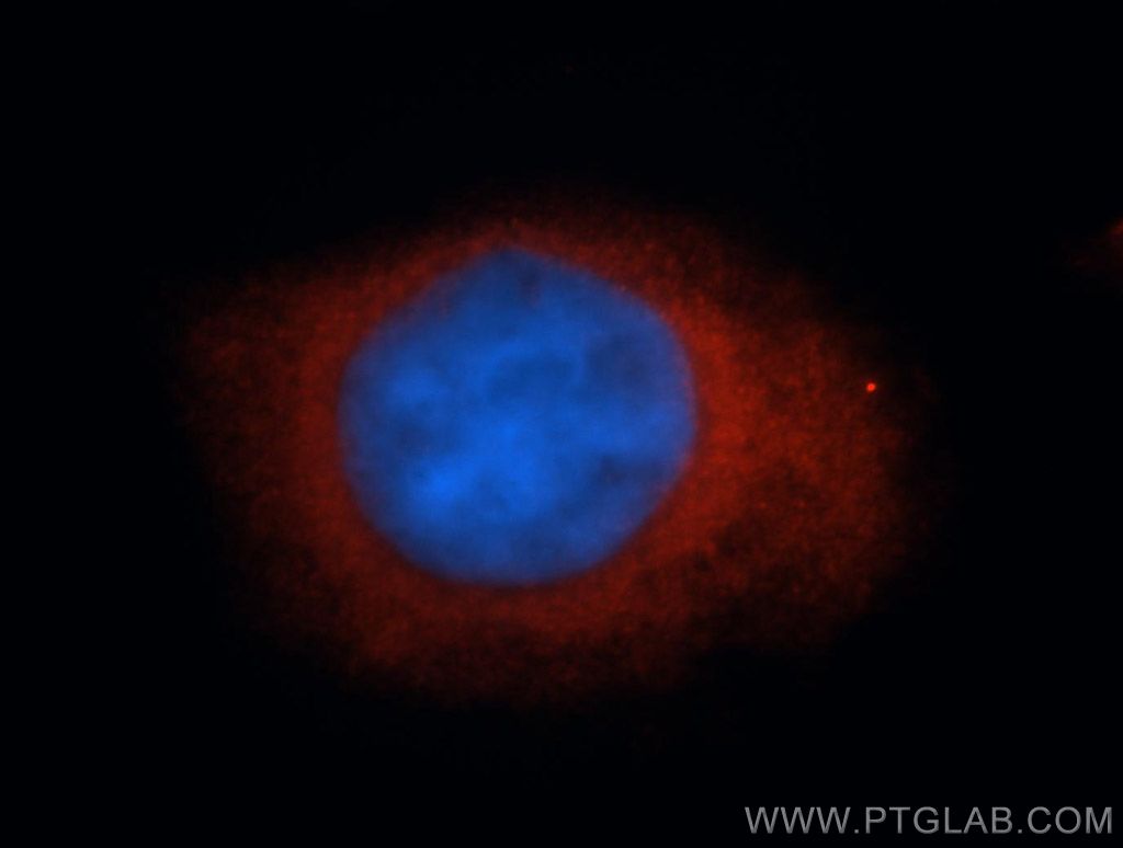 DVL3 Polyclonal antibody