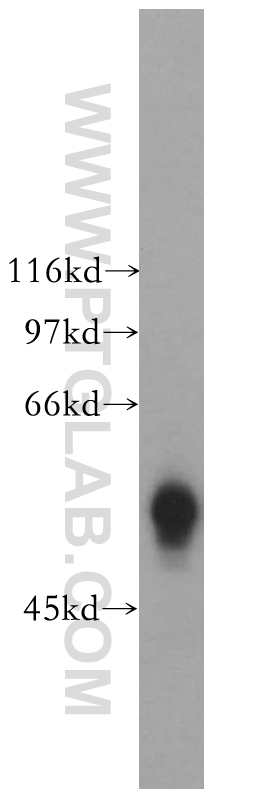 GK5 Polyclonal antibody
