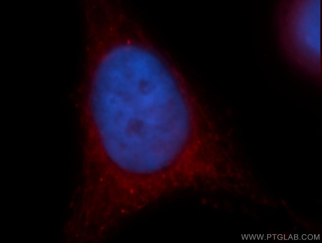 Cryptochrome 1 Polyclonal antibody
