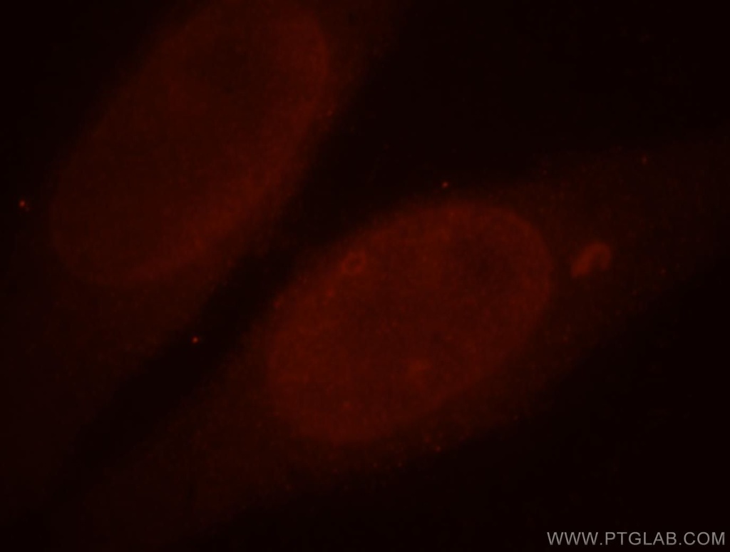 ALLC Polyclonal antibody
