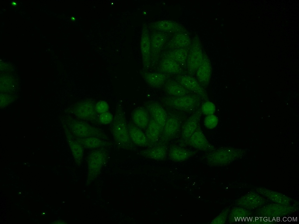 PIAS3 Polyclonal antibody