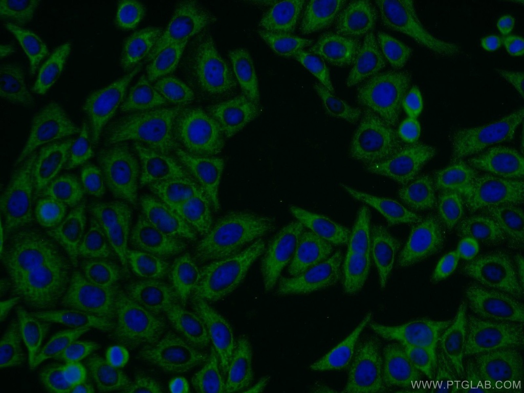 MTMR4 Polyclonal antibody