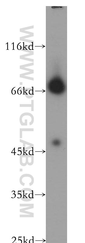 NLGN4Y Polyclonal antibody