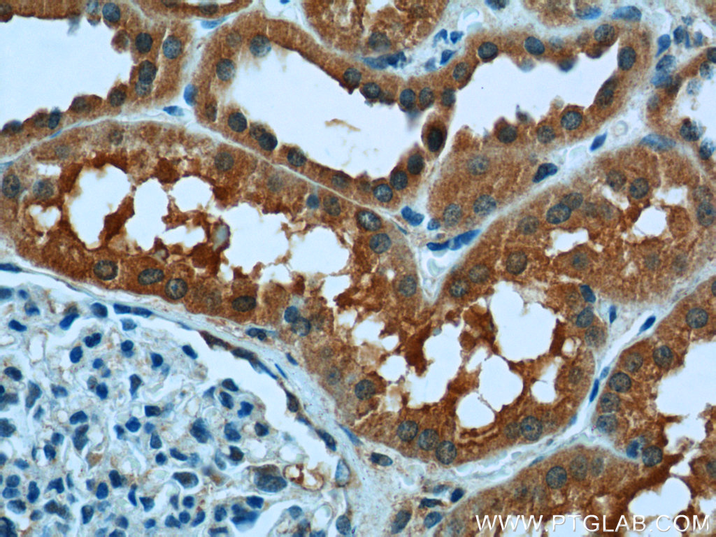 USP46 Polyclonal antibody
