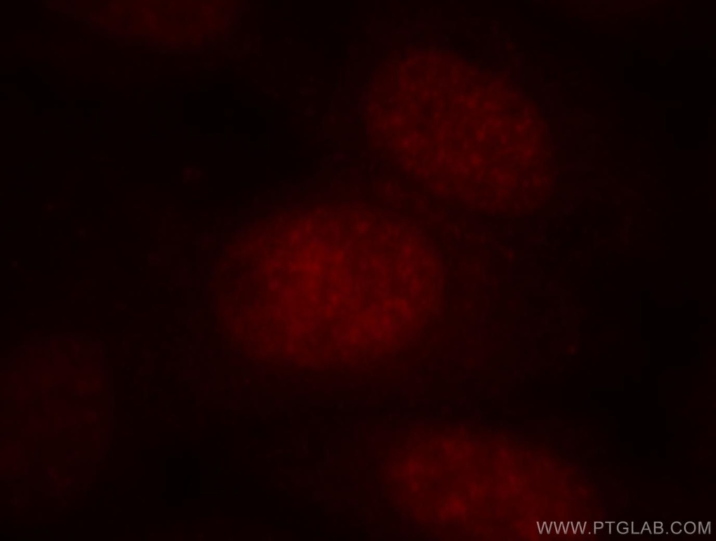 BATF Polyclonal antibody
