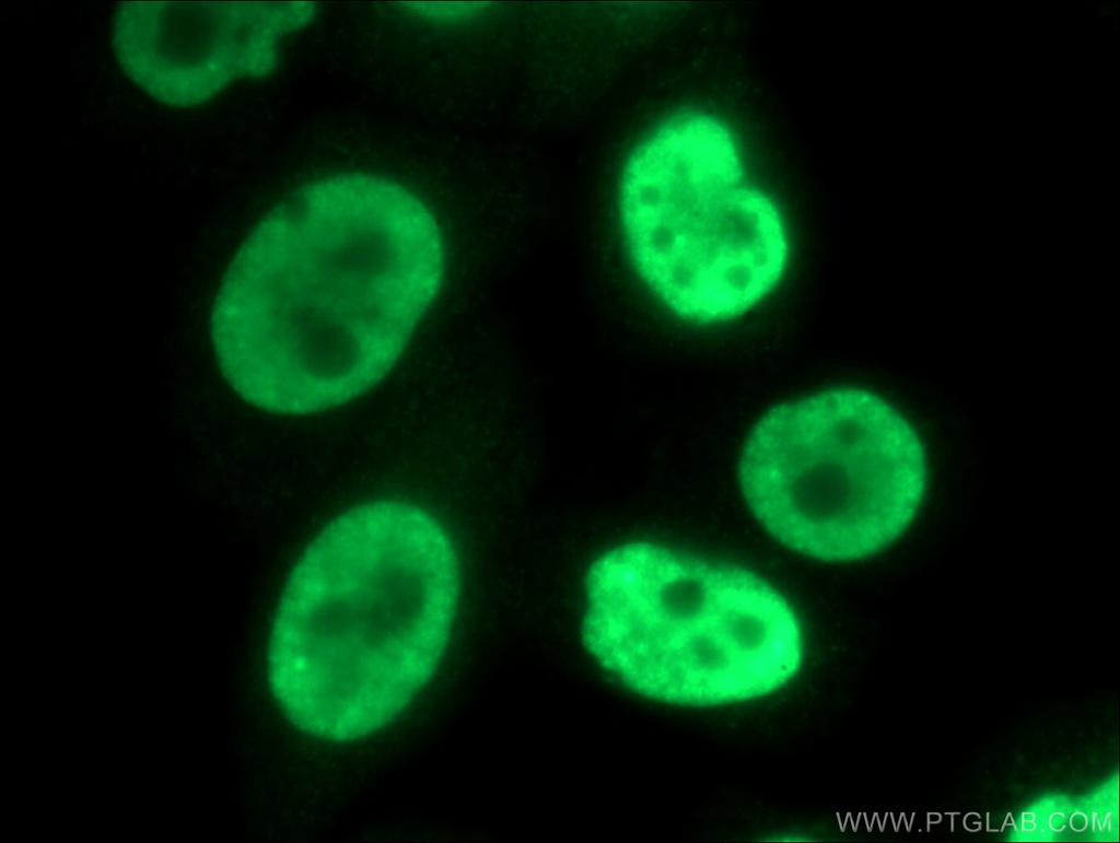 SNRPB2 Polyclonal antibody