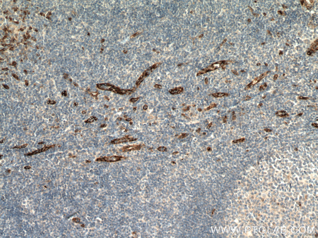SPARCL1 Polyclonal antibody