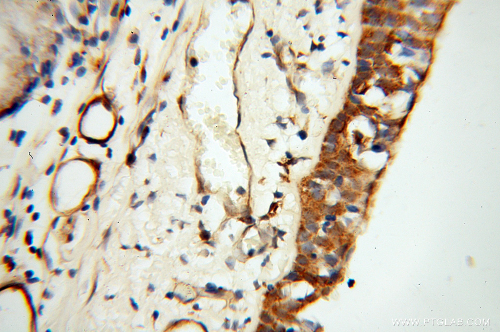 TEKT2 Polyclonal antibody