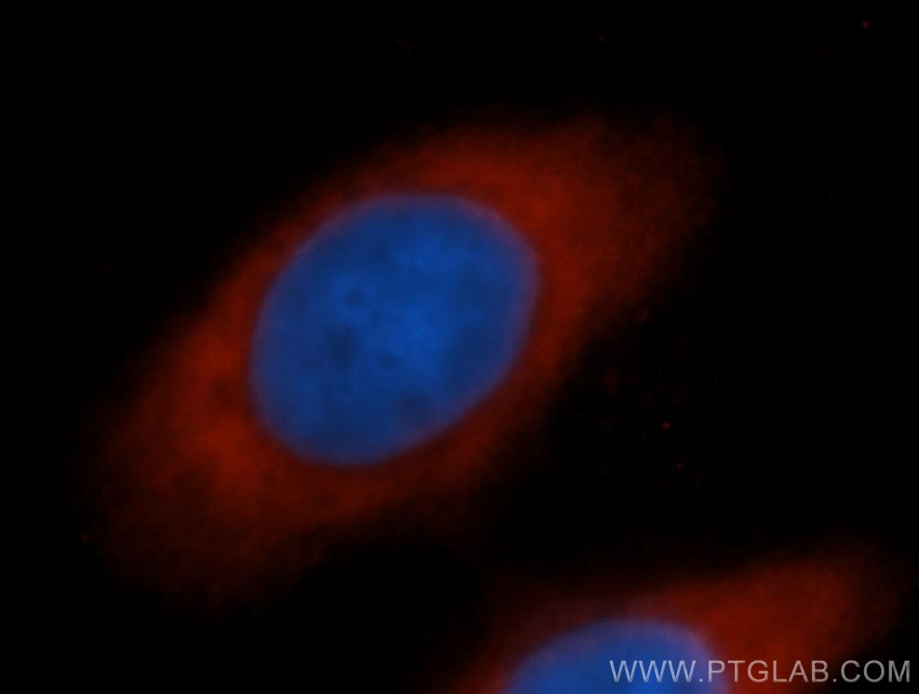 EIF5B Polyclonal antibody