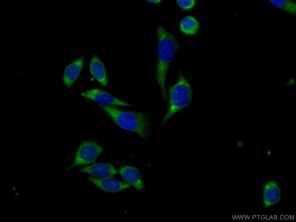 FSCN3 Polyclonal antibody