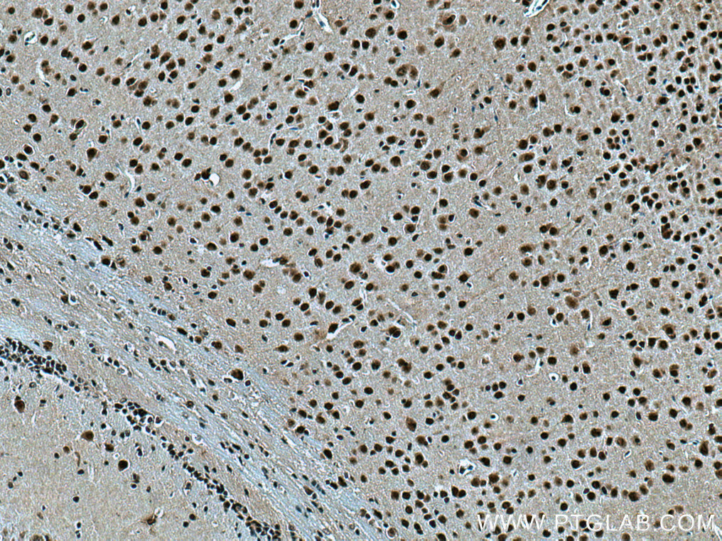 TBL1X Polyclonal antibody