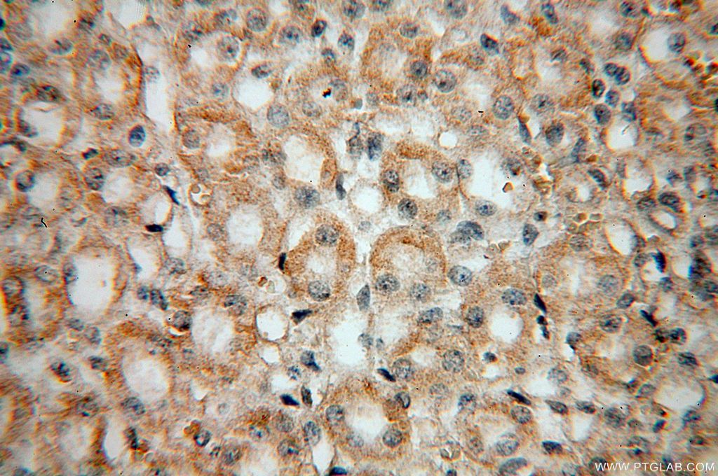 PDSS2 Polyclonal antibody