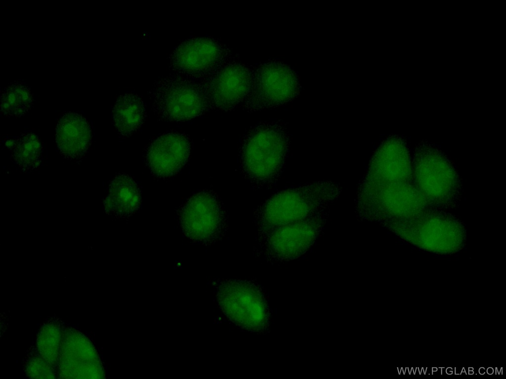 PES1 Polyclonal antibody