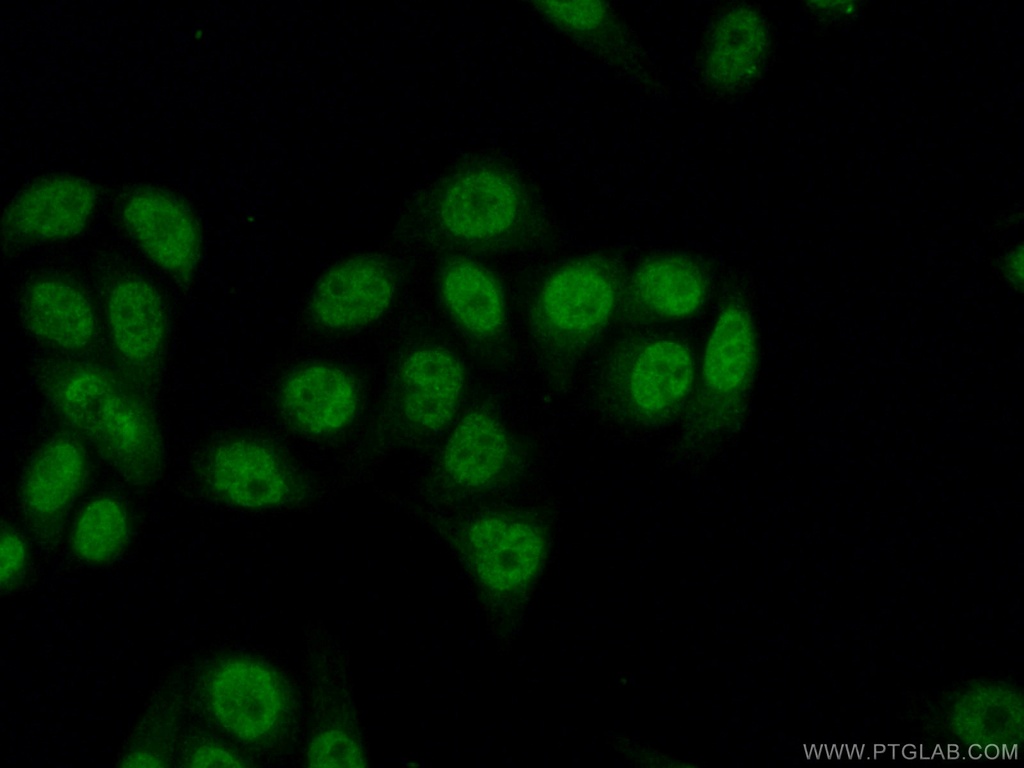 IKZF2 Polyclonal antibody