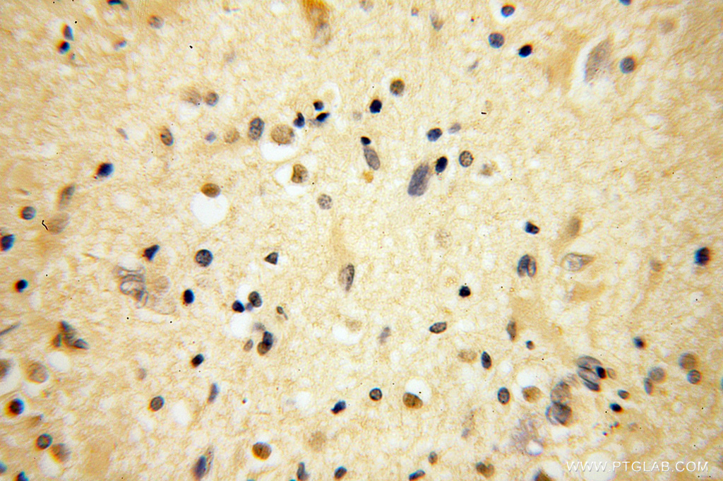 BRUNOL5 Polyclonal antibody