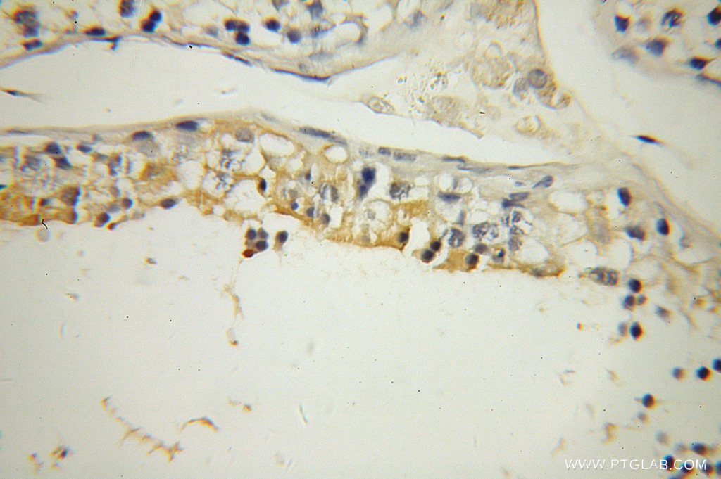 UBQLN3 Polyclonal antibody