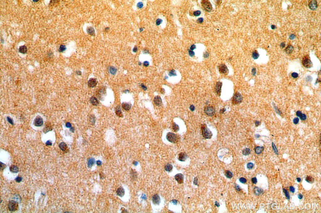 SIRT6 Polyclonal antibody