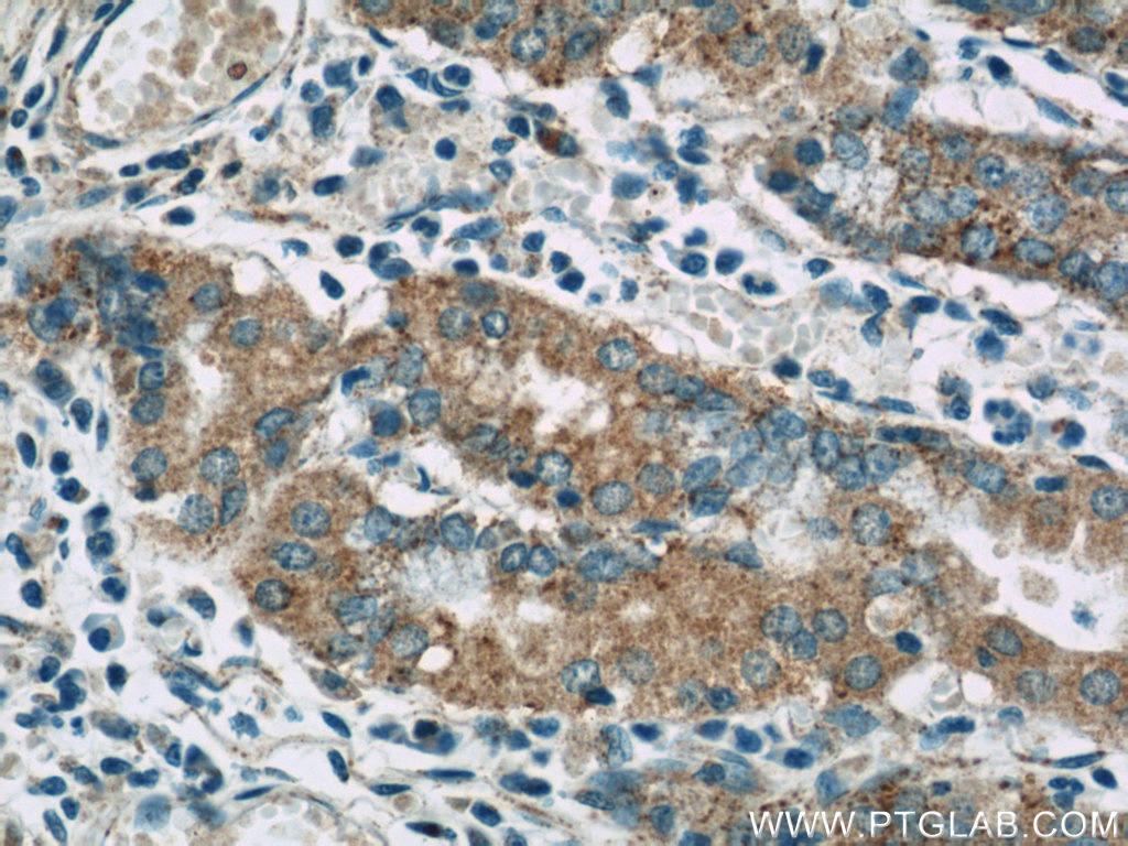 FAU Polyclonal antibody
