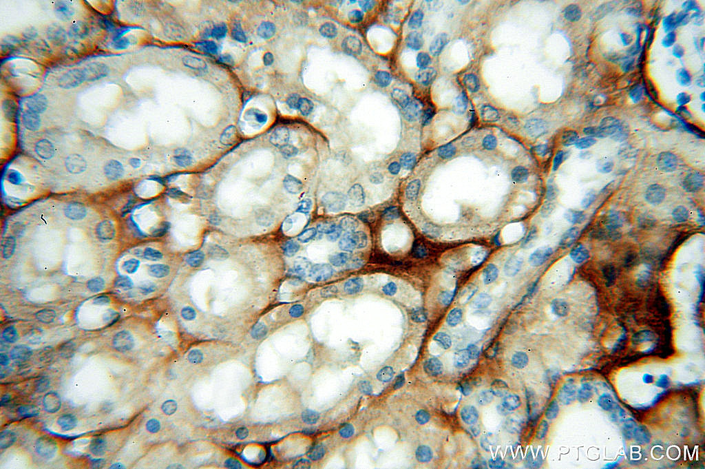 Tenascin-X Polyclonal antibody