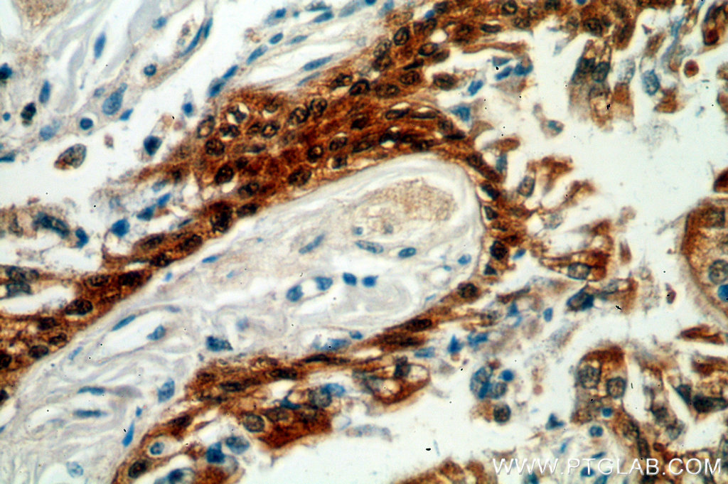 HSPA6 Polyclonal antibody