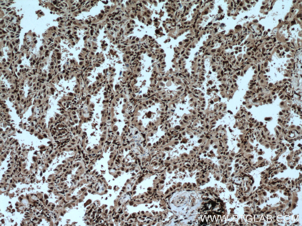 GMFG Polyclonal antibody
