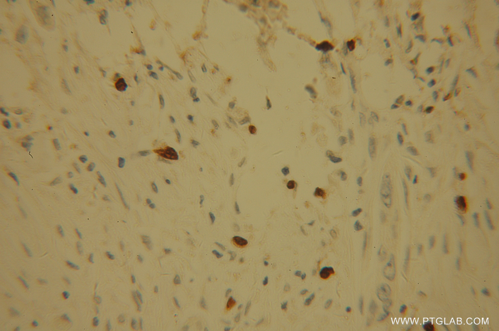 POLI Polyclonal antibody