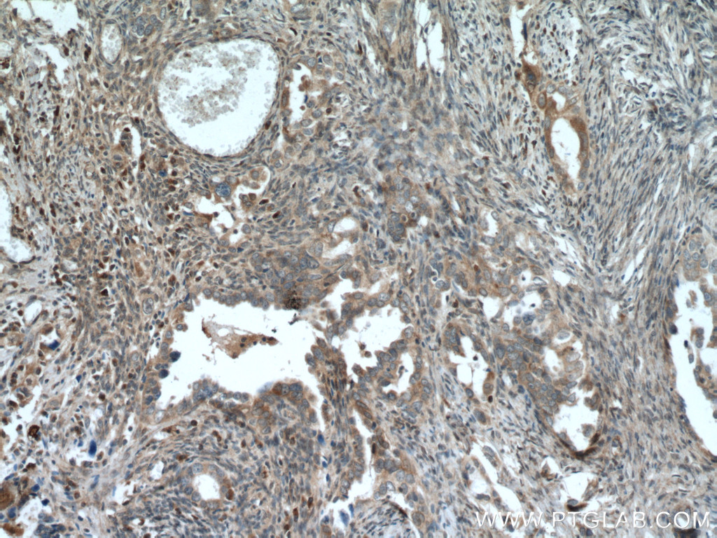 TULP3 Polyclonal antibody