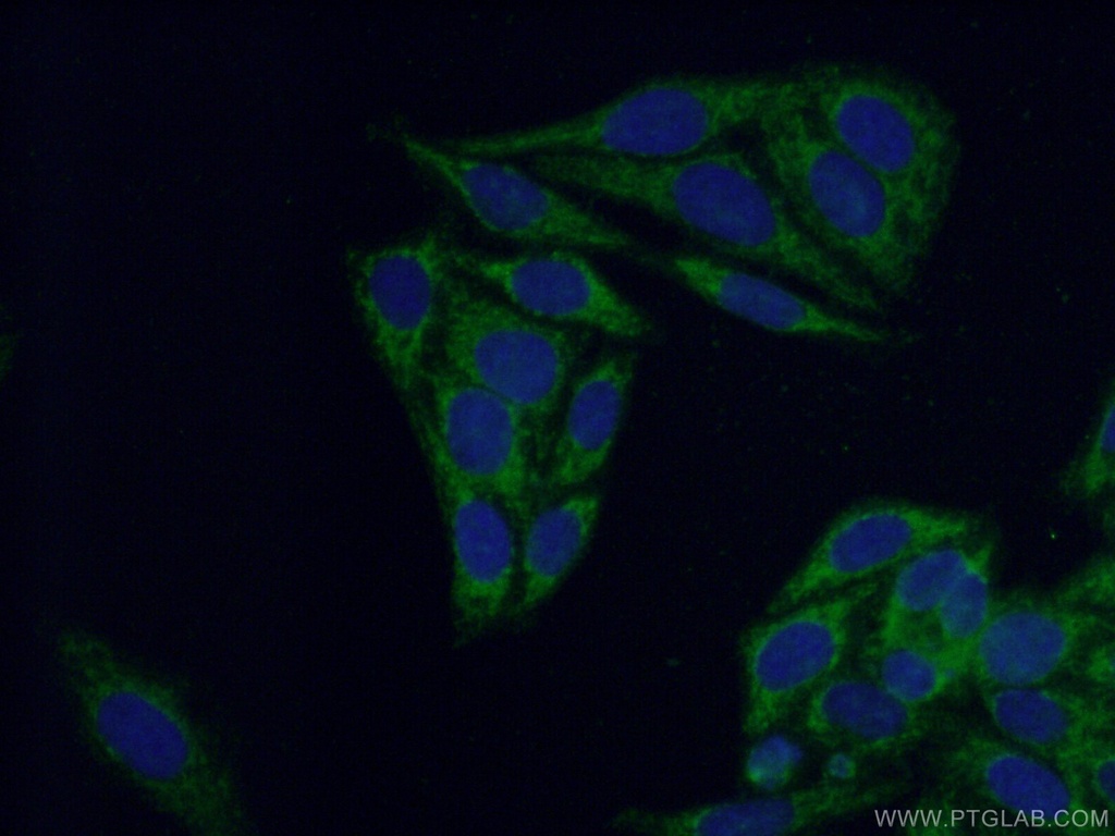 BCAT1/ECA39 Polyclonal antibody