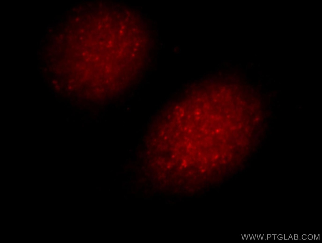 UIMC1 Polyclonal antibody