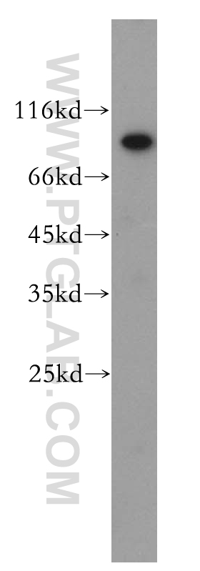 TIGD5 Polyclonal antibody