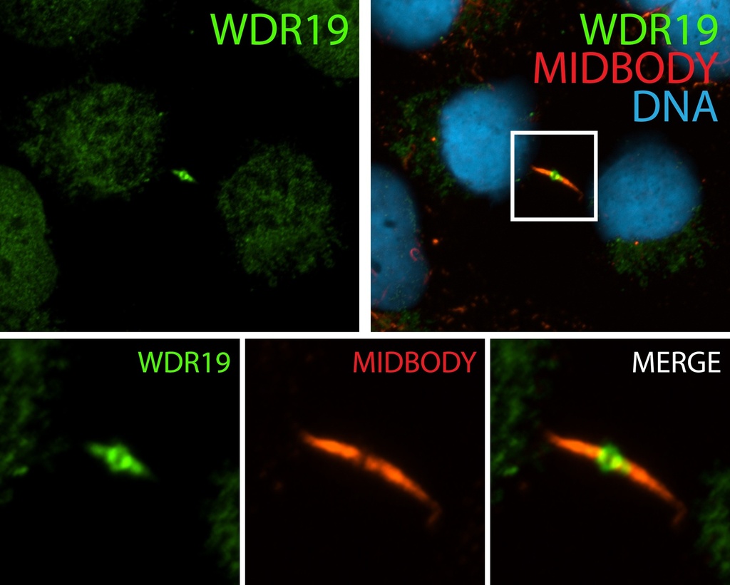 WDR19/IFT144 Polyclonal antibody