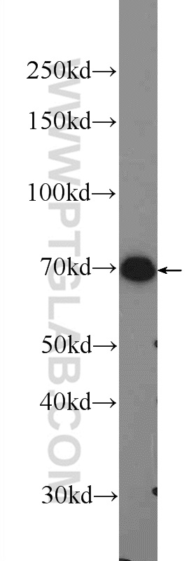 PRAM1 Polyclonal antibody