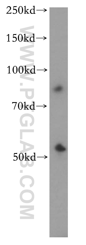CYP2S1 Polyclonal antibody