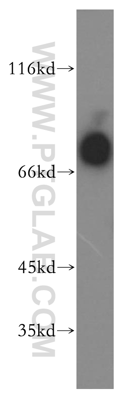 IL-3RA Polyclonal antibody